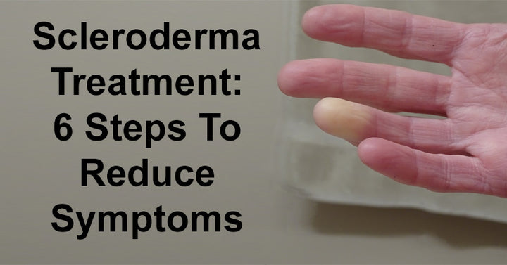 Scleroderma Treatment: 6 Steps To Reduce Symptoms