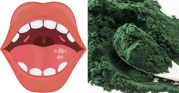 Algae: 7 Health Benefits