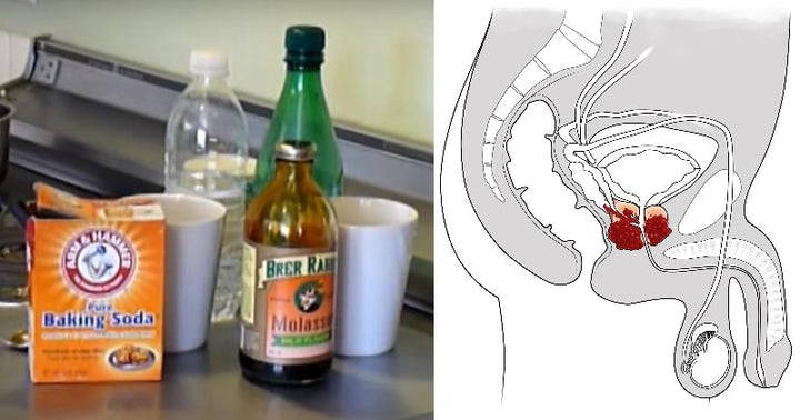 baking soda cancer FI
