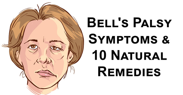 bells palsy FI