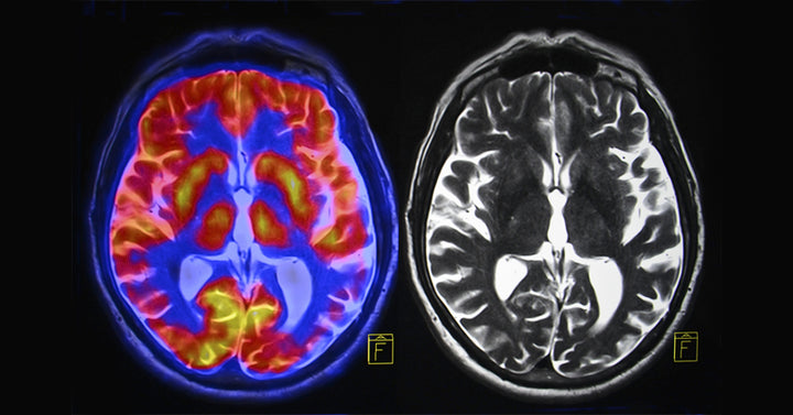 brain generosity FI