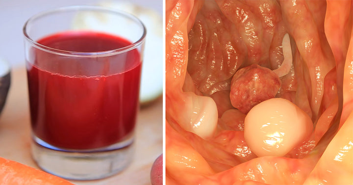 cancer juice FI