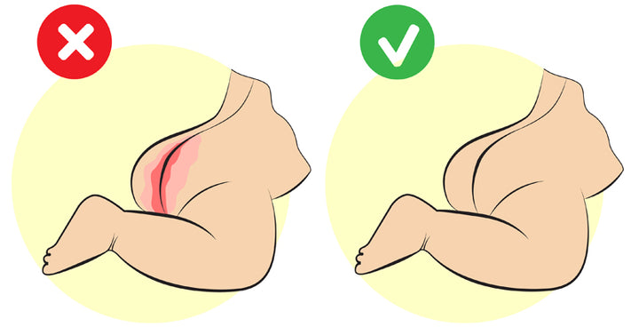 diaper rash treatment FI