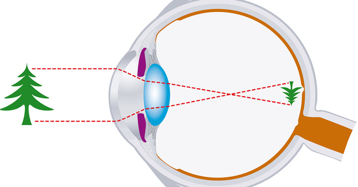 eyesight FI