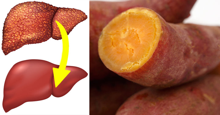 foods reverse liver disease FI