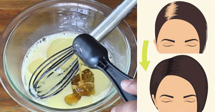 hair growth mixture FI