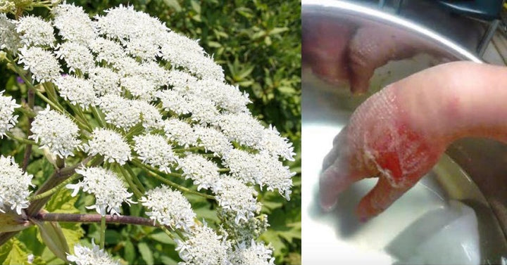 hogweed