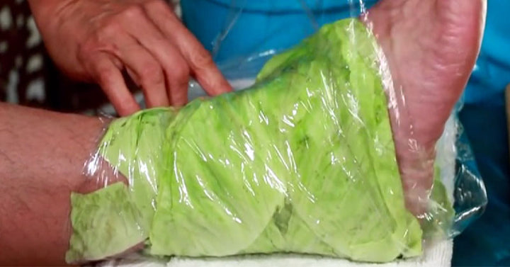 joints cabbage FI