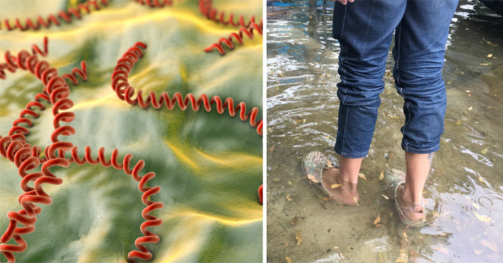 Leptospirosis Symptoms & 6 Steps To Prevent It