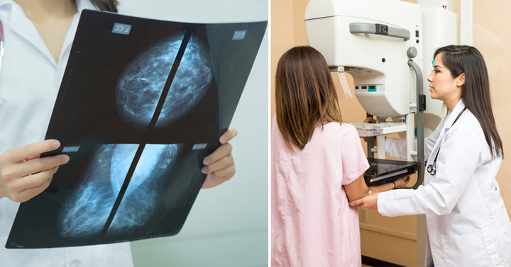 mammogram FI