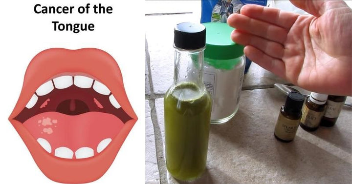 mouthwash FI