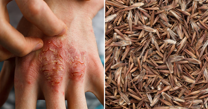 Palmarosa Essential Oil: 8 Health Uses