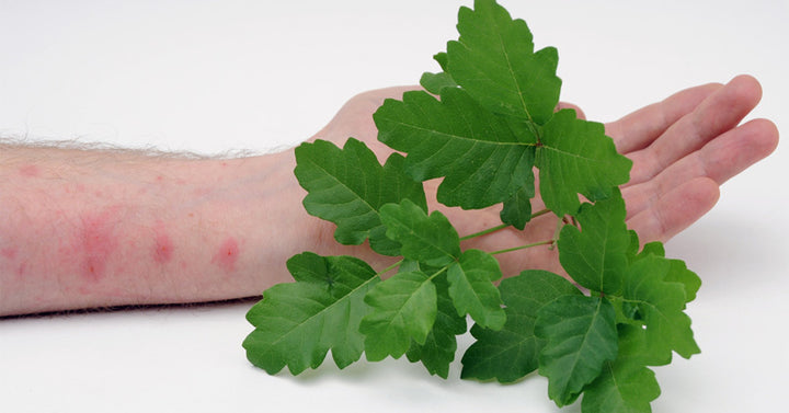 Poison Oak Treatment: Symptoms & 5 Natural Treatments