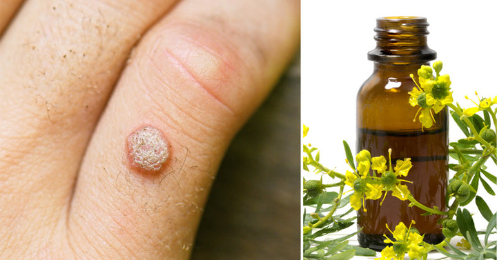 Rue Essential Oil: 9 Uses & Benefits