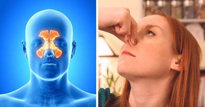 sinus congestion FI