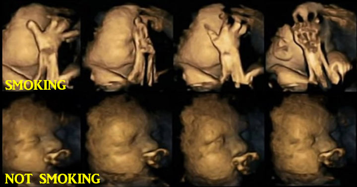 smoking pregnant FI