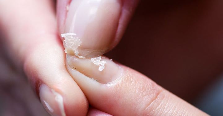 splitting nails FI