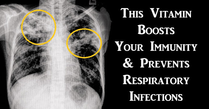 vitamin infections FI