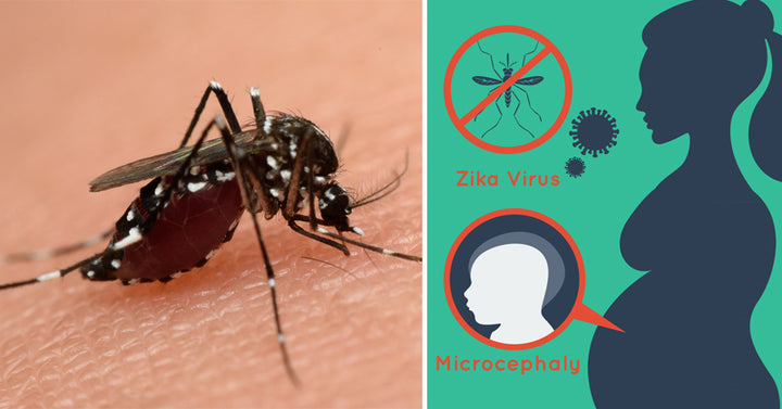 zika signs FI