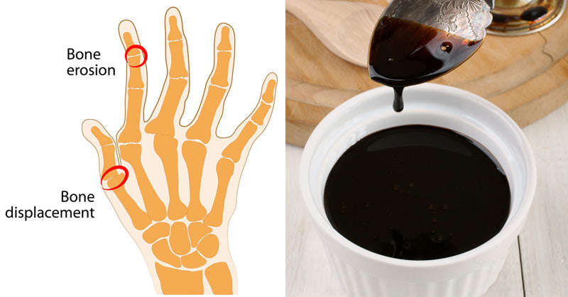 Blackstrap Molasses: 9 Health Benefits