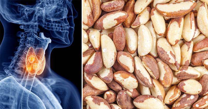 Brazil Nuts: 5 Health Benefits