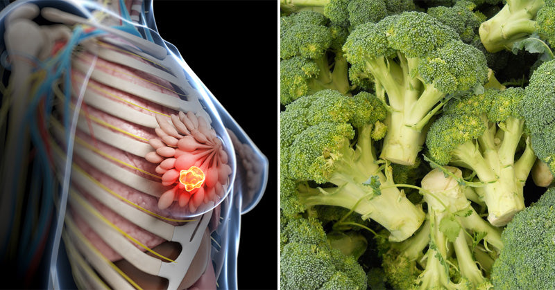 Broccoli: 10 Health Benefits