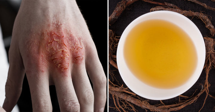 Dandelion tea health benefits FI