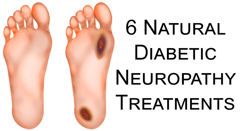 Diabetic Neuropathy FI