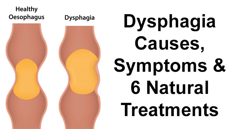 Dysphagia FI