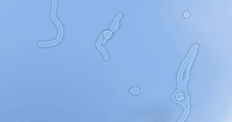 Floaters FI