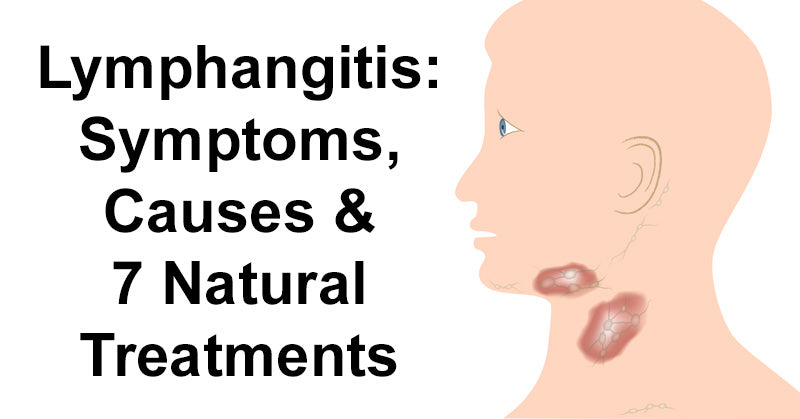 Lymphangitis: Symptoms, Causes & 7 Natural Treatments