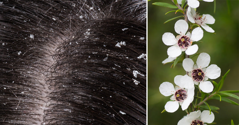 Manuka Essential Oil: 10 Health & Beauty Uses
