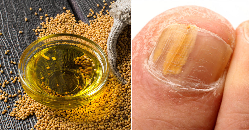Mustard Essential Oil: 10 Health Uses