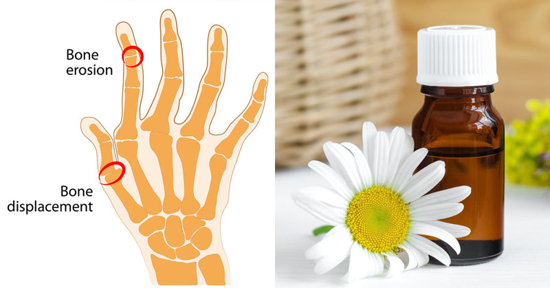 Roman Chamomile Essential Oil FI
