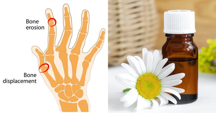 Roman Chamomile Essential Oil FI