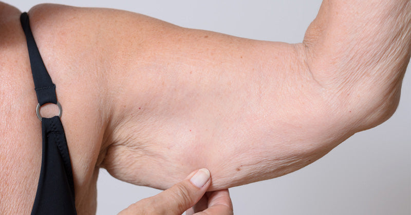 Sarcopenia: Symptoms, Causes & 10 Natural Treatments