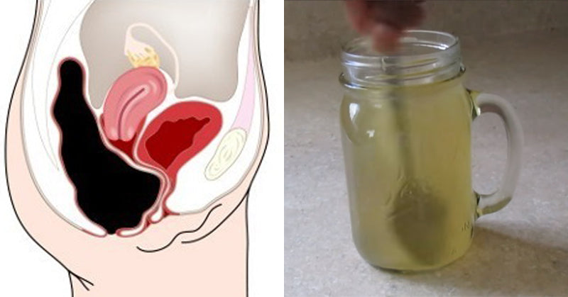 acv honey apple cider vinegar detox colon cleanse FI