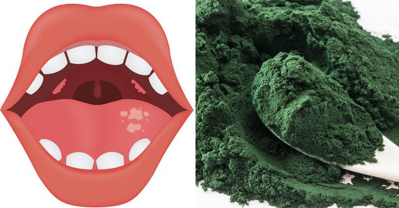 Algae: 7 Health Benefits