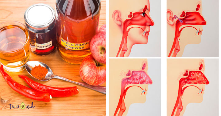 apple-cider-sinus-infection