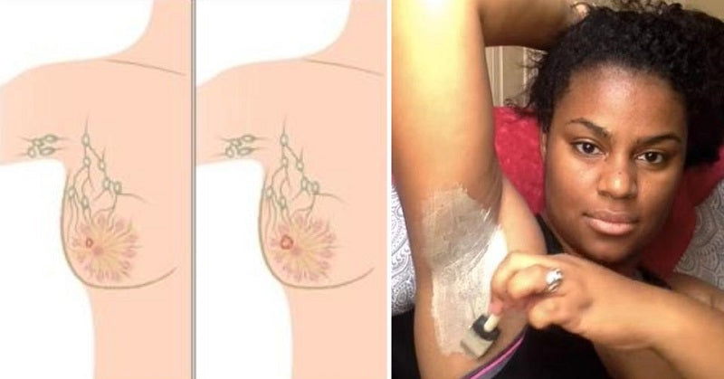 armpit detox