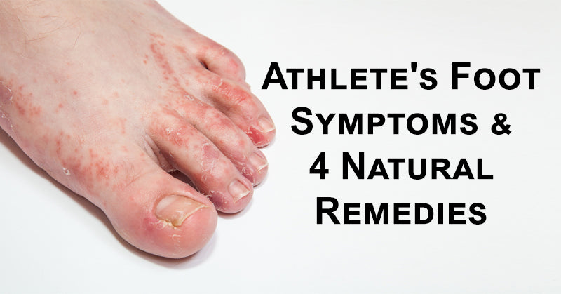 athletes foot FI