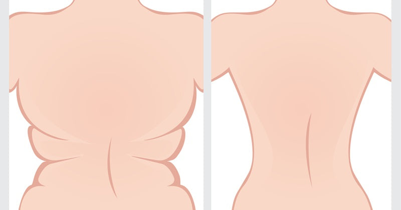 back fat FI
