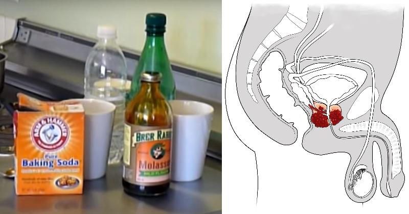 baking soda cancer FI