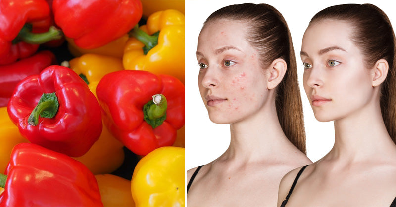 Bell Peppers: 7 Health Benefits