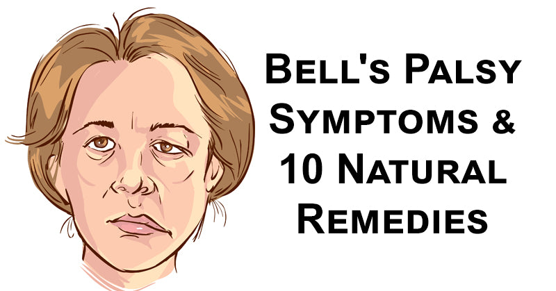 bells palsy FI
