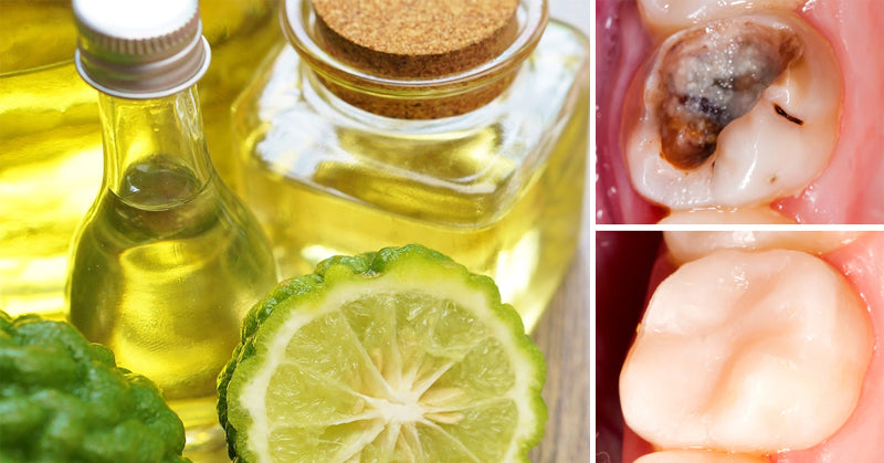 bergamot oil FI