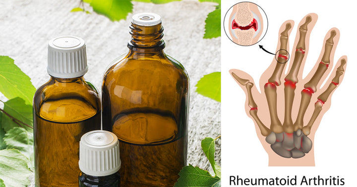 Birch Essential Oil: 10 Uses & Benefits