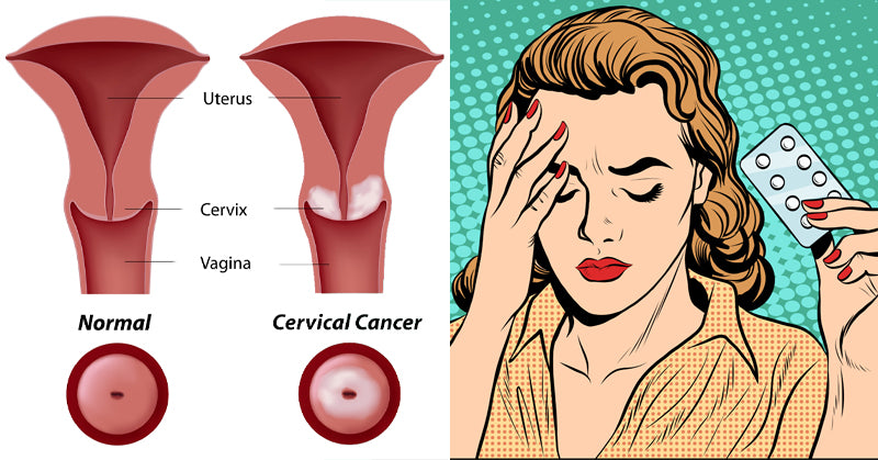 birth control pills FI