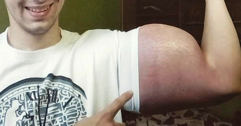 bodybuilder arm FI