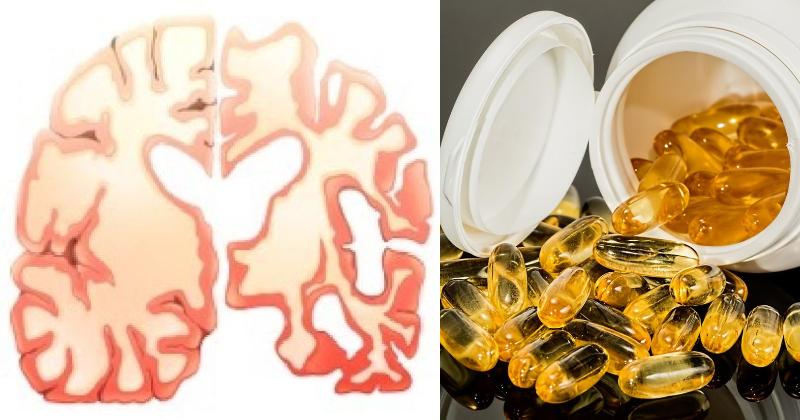 brain vitamins FI